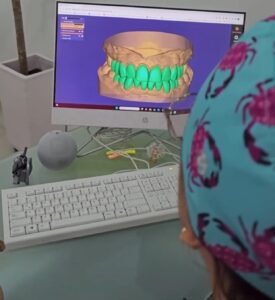 smile design porcelain veneer scanner intraoral planning